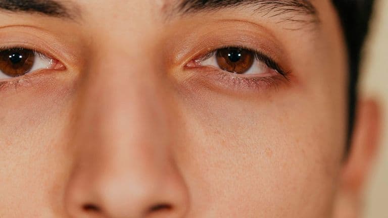 Tom Sandoval Reveals Details Behind His Black Eye in ‘Vanderpump Rules’ Midseason Trailer